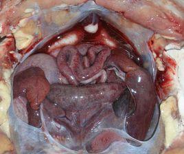 腸道寄生蟲 腸道寄生蟲