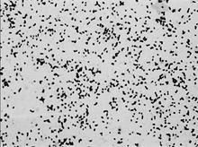 睪丸酮叢毛單胞菌 睪丸酮叢毛單胞菌