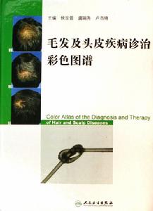 毛髮及頭皮疾病診治彩色圖譜 毛髮及頭皮疾病診治彩色圖譜