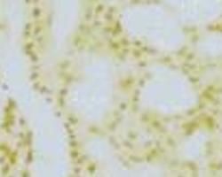 Bcl-2蛋白 Bcl-2蛋白