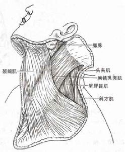 急性化膿性乳突炎
