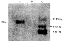 常染色體顯性多囊腎 常染色體顯性多囊腎
