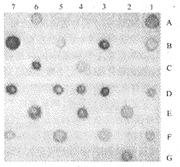 耶爾森菌腸炎 耶爾森菌腸炎