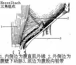 Hesselbach三角 Hesselbach三角