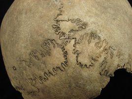 顱的頂面觀 顱的頂面觀