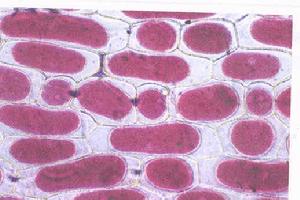 細胞質壁分離些微結構
