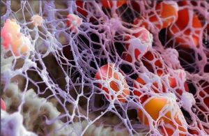 血纖維蛋白 血纖維蛋白