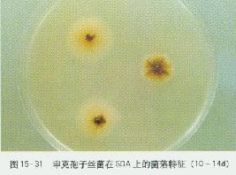 申克孢子絲菌 申克孢子絲菌