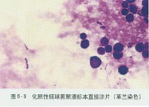 地衣芽孢桿菌