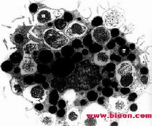 組織細胞增殖症