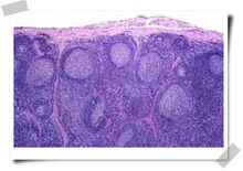 高倍顯微鏡下淋巴結HE染色圖