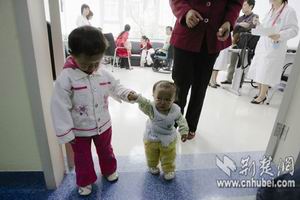 生長激素缺乏性侏儒症