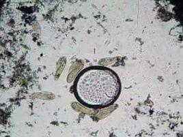 鈍漫遊蟲 鈍漫遊蟲