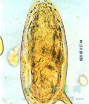 血吸蟲病酶聯免疫吸附試驗