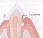 牙槽骨膜