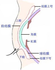 眼瞼結構圖