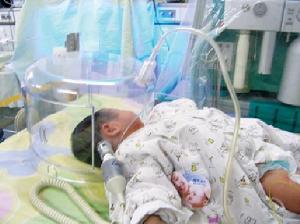 新生兒呼吸暫停