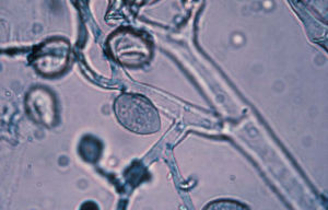 煙霜霉病菌 煙霜霉病菌