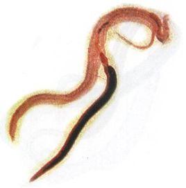 吸血蟲病 吸血蟲病