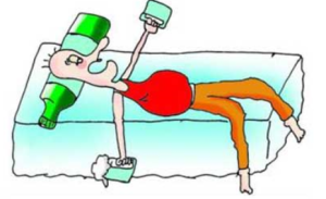 酒精戒斷綜合徵 酒精戒斷綜合徵