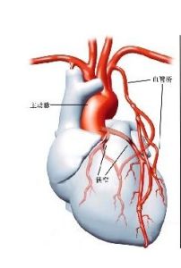 心臟搭橋 心臟搭橋