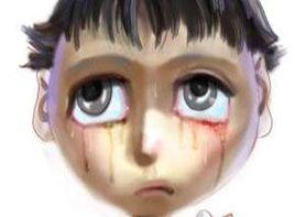 淚腺不發達 淚腺不發達