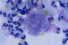 吉姆薩染液 吉姆薩染液