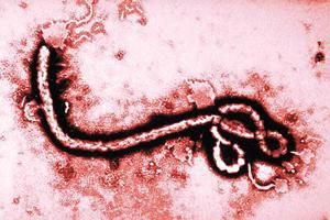 伊波拉病毒病