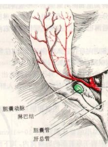 膽囊三角 膽囊三角