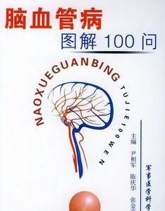 腦血管病圖解100問