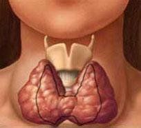 甲狀腺囊腺瘤 甲狀腺囊腺瘤