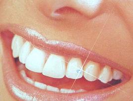 水晶牙飾 水晶牙飾