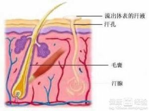 汗孔周圍炎及多發性汗腺膿腫 汗孔周圍炎及多發性汗腺膿腫