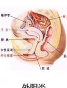 外陰痛 外陰痛