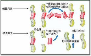 染色體異常遺傳病
