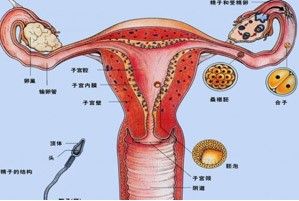 子宮縱隔 子宮縱隔