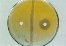 類志賀鄰單胞菌 類志賀鄰單胞菌