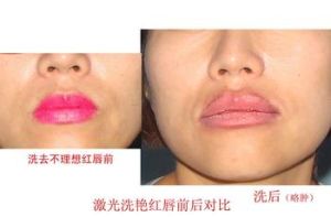 洗唇線 洗唇線