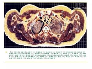 醫學影像解剖圖譜