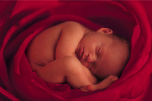 羊水過多 羊水過多