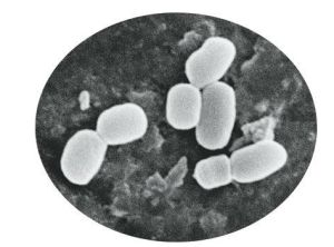 放大了2萬倍的兵馬俑芽胞桿菌