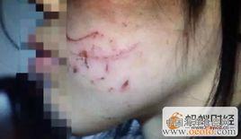 6·5汕頭姐弟遭虐打事件 6·5汕頭姐弟遭虐打事件