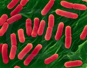 溶血尿毒綜合症