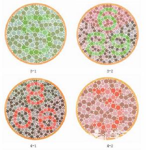 黃綠色盲 黃綠色盲