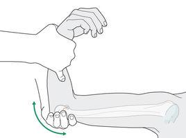 肱骨滑車 肱骨滑車