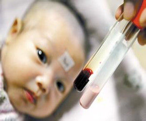 乳白色血液 乳白色血液