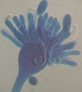 蒂蓋姆頭珠霉 蒂蓋姆頭珠霉