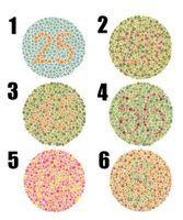 黃藍色盲 黃藍色盲