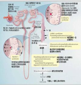 假性醛固酮症 假性醛固酮症