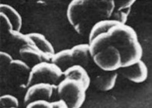 產甲烷菌屬 產甲烷菌屬